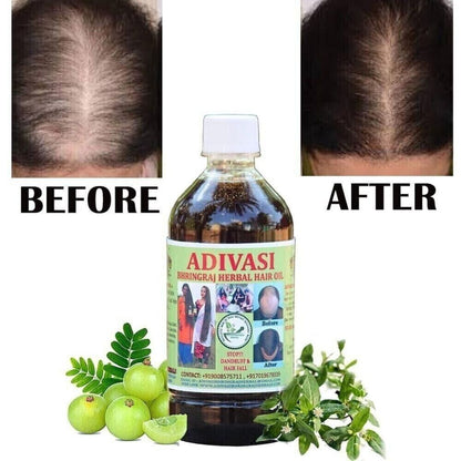 Ayurvedic Adivasi Herbal Hair Oil Pure Herbal Hair Care Adivasi Hair Growth And Hair Fall Control Oil | Repairs Frizzy Hair Nourishment | 125ml Pack of 2